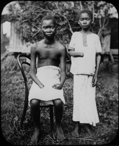 Punishment for not collecting enough of the rubber plant in Belgium Congo ca 1908